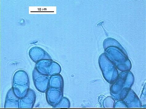 Lignincola longirostris (Cribb & Cribb) Kohlm
