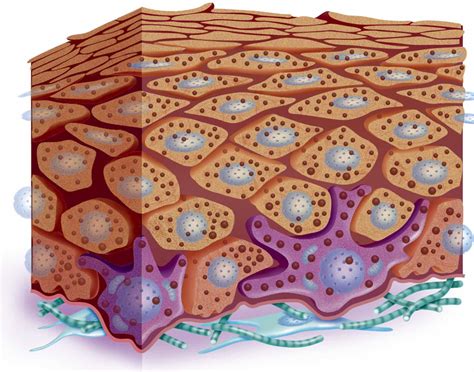 Understanding Ehlers-Danlos syndromes