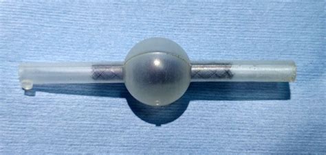 Flow Diverter Stent developed by SCTIMST for treatment of Aneurysms of ...