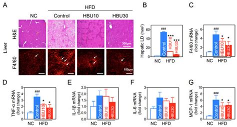 A Novel Aryl Hydrocarbon Receptor Antagonist HBU651 Ameliorates ...