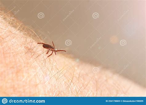Image result for Embedded Deer Tick
