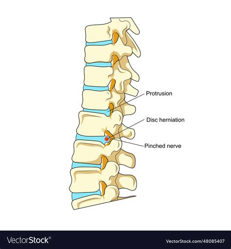 Disk Problem 的图像结果