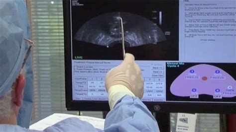 Image result for Colon Cancer Testing