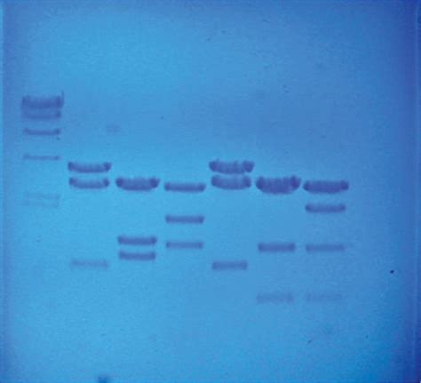 Biotechnology DNA Fingerprinting 的图像结果