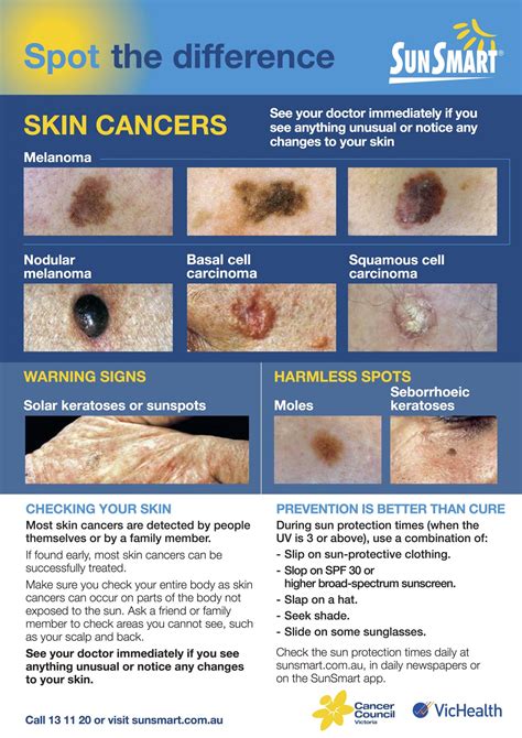 Skin Checks & Mole Removal - Cranbourne & Croydon | HealthMint