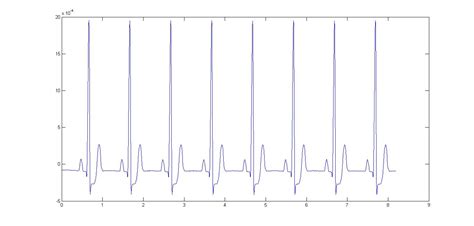 Image result for Signal Filtering MATLAB