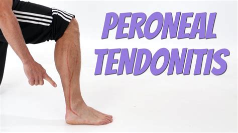 Peroneal Tendonitis (Side of Foot Pain), Causes & Self-Treatment. - YouTube