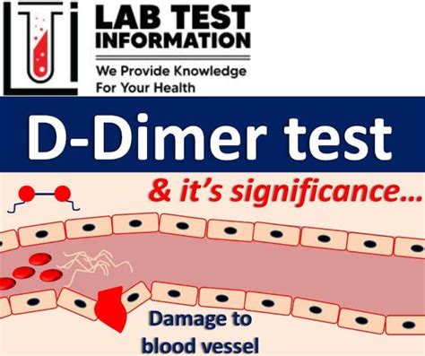 Image result for D-dimer Normal Lab Range