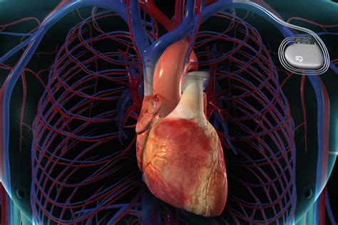 Image result for Installing Pacemaker