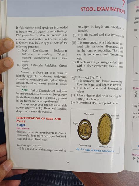 Image result for Stool Analysis Procedure