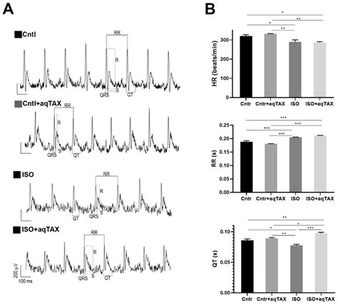Pathological Alterations in Heart Mitochondria in a Rat Model of ...