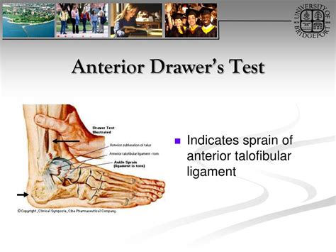 PPT - Ankle and Foot Orthopaedic Tests Orthopedics and Neurology DX 612 ...