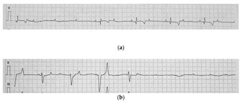 Single-Chamber Cardiac Pacemaker Implantation in a Donkey with Complete ...