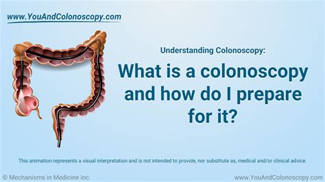 Image result for Colonoscopy Looping