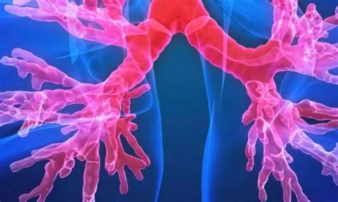 Hypertonic Saline and Carbocisteine Fail to Reduce Pulmonary ...