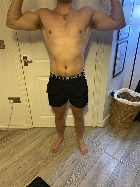 Shoulder striations??? : r/GYM