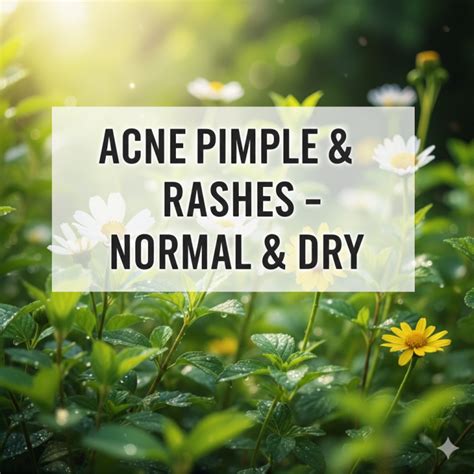 ACNE PIMPLE & RASHES - NORMAL & DRY - ROYAL BOTANICA