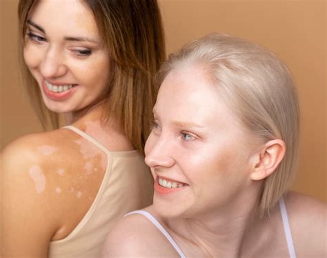 Page 58 | Rashes Images - Free Download on Freepik