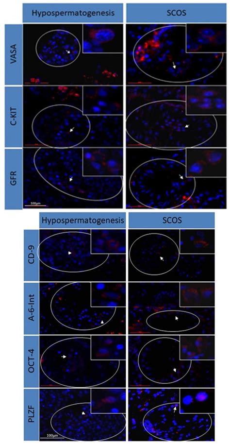 Identification of Premeiotic, Meiotic, and Postmeiotic Cells in ...