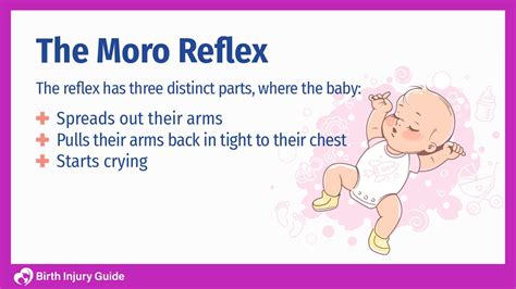Moro Reflex Testing 的图像结果