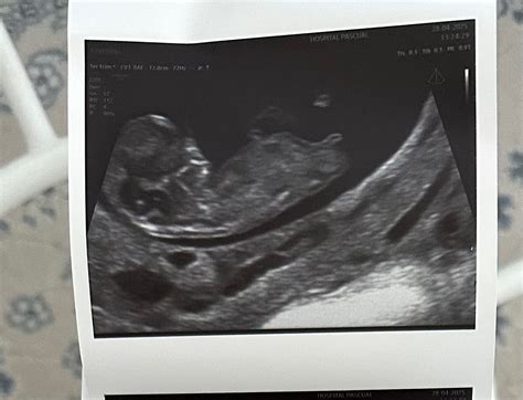 Qué creéis que es según el tubérculo? - Page 2 | BabyCenter