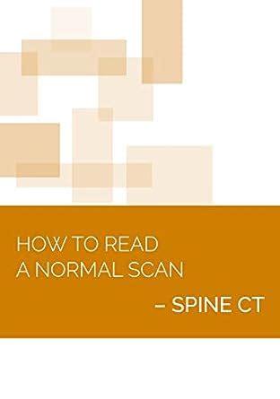 How to Read a Normal Scan : SPINE CT (NEURORADIOLOGY: How to Read a ...
