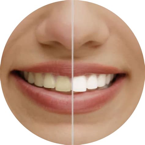 Image result for Colgate Lemon Fresh Gel Toothpaste