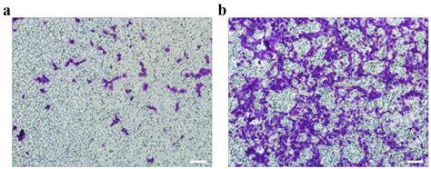 Lyophilized Gelatin@non-Woven Scaffold to Promote Spheroids Formation ...