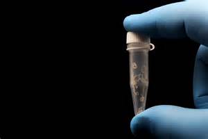 The 30 most terrifying parasitic diseases in the world