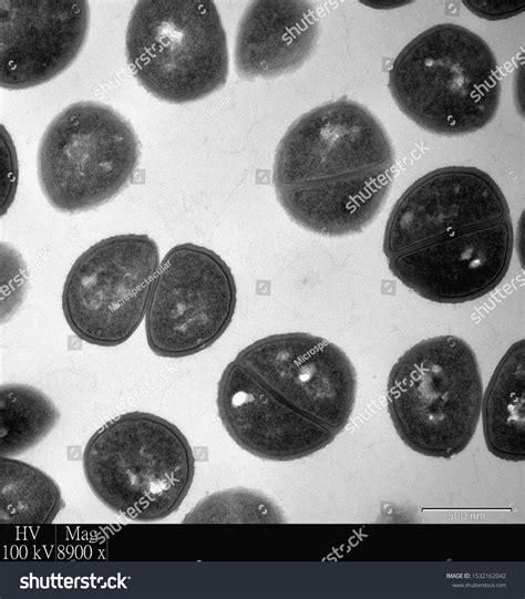 Binary Fission Bacteria: Over 72 Royalty-Free Licensable Stock Photos ...