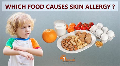 skin allergies | skin allergies treatment | skin allergies in ...