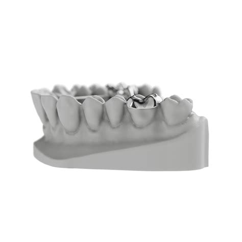 Image result for Mini RPE Expander