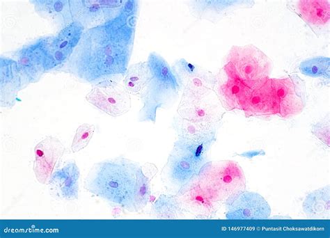 Squamous Epithelial Cells Under Microscope View For Education Histology ...