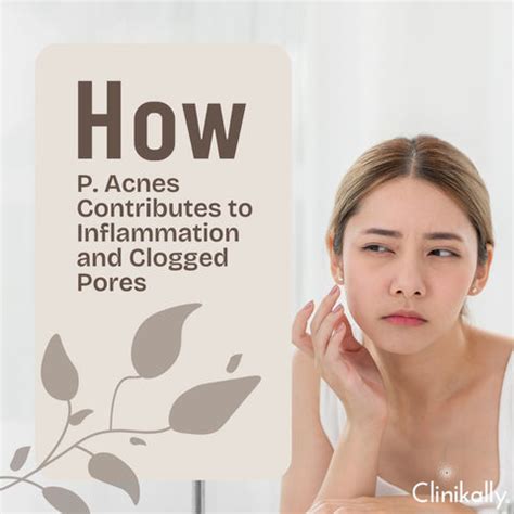 Unpacking Propionibacterium acnes: The Science Behind Acne | Clinikally