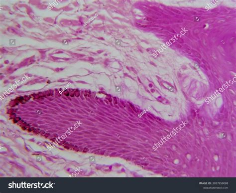 Ruffini Corpuscle Histology