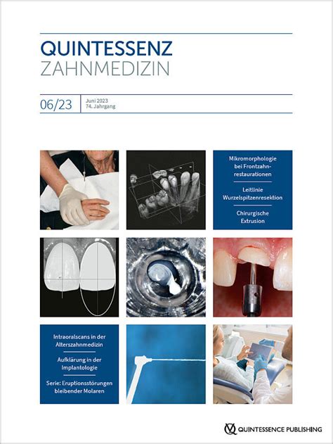 Keratozyste im Unterkiefer links | Quintessenz Verlags-GmbH