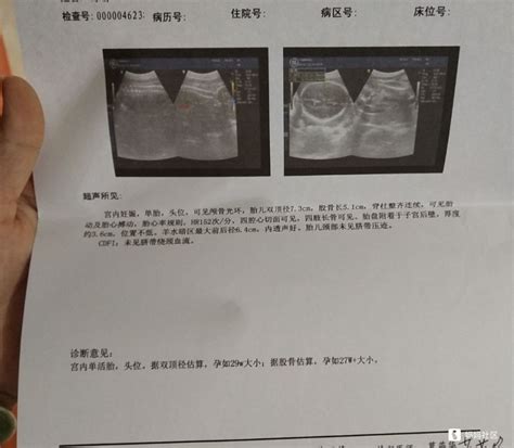 孕29周胎儿发育情况_怀孕29周肚子的照片 - 随意云