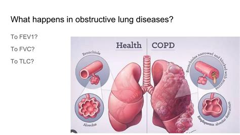 Obstructive vs Restrictive Pulmonary Disease - Pathology - ATOT | PPTX