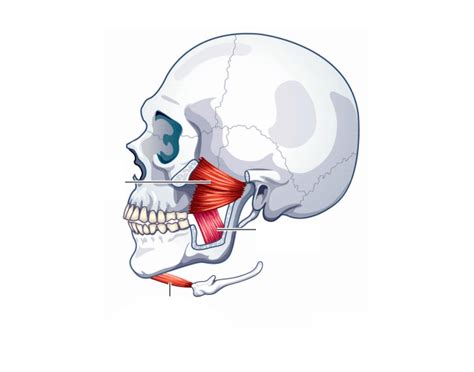 Image result for Masseter Muscle Trigger Point