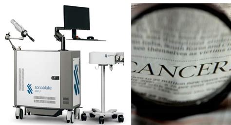 Kolkata: Unique Device For Treatment Of Prostate Cancer Launched ...