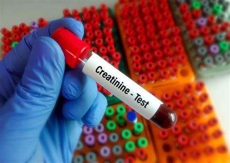 Image result for Creatinine Lab Testing