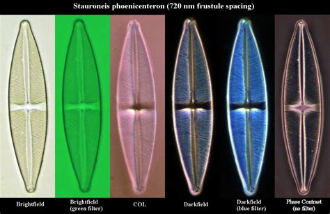 Image result for Phase Contrast Microscopy Applications