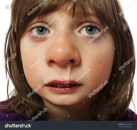 Runny Nose - Cold - Ill Little Girl Stock Photo 122908393 : Shutterstock