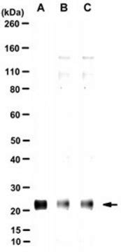 Anti-GINS1 Antibody, clone 192B | Sigma-Aldrich