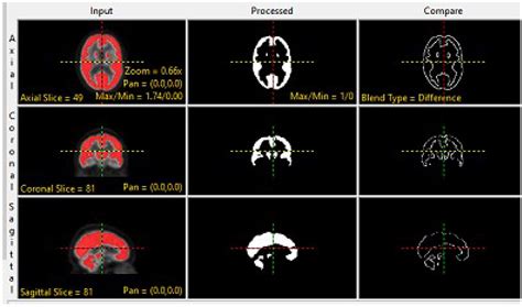 Pareto Optimized Adaptive Learning with Transposed Convolution for ...