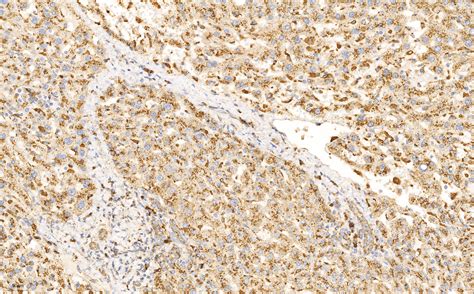 Cathepsin D antibody (66534-1-Ig) | Proteintech