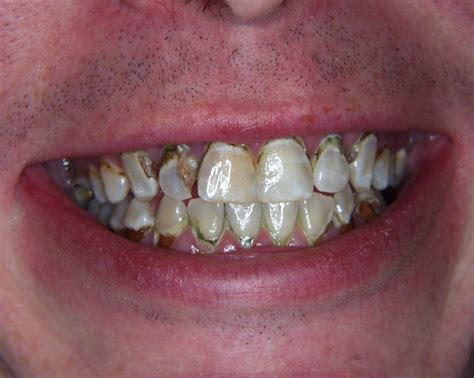 Yelawolf Mountain Dew Mouth Freestyle Reaction