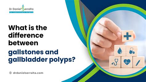 Pilonidal Sinus Surgery: Treatment, Procedure, And Recovery - Dr. Daniel Serralta