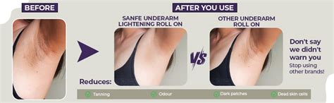 Buy Sanfe Underarm Lightening Roll On (Oudh) with 5% AHA, Glycolic Acid ...