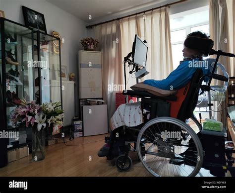35-year-old Chinese man in the late stages of Amyotrophic Lateral Sclerosis (ALS) uses the ...
